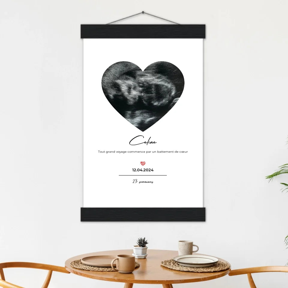 Premières semaines - Affiche Personnalisée